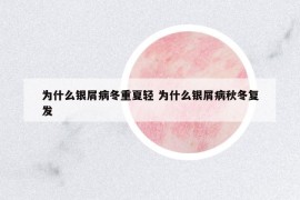 为什么银屑病冬重夏轻 为什么银屑病秋冬复发