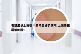 看银屑病上海哪个医院最好的医院 上海看银屑病的医生