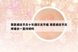 银屑病关节炎十年偶尔关节痛 银屑病关节炎疼痛会一直持续吗
