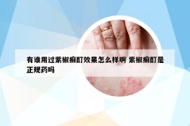 有谁用过紫椒癣酊效果怎么样啊 紫椒癣酊是正规药吗