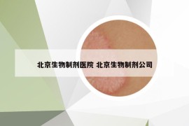 北京生物制剂医院 北京生物制剂公司
