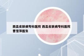 西昌皮肤病专科医院 西昌皮肤病专科医院 曹雪萍医生