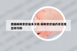 德国赫斯奈舒迪多少钱 赫斯奈舒迪药膏百度怎样代购