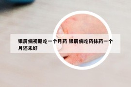 银屑病初期吃一个月药 银屑病吃药抹药一个月还未好