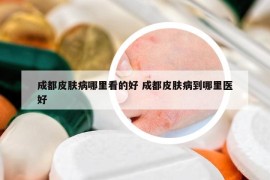 成都皮肤病哪里看的好 成都皮肤病到哪里医好