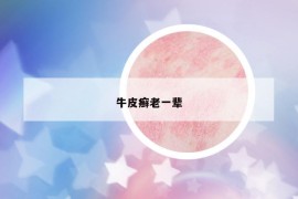 牛皮癣老一辈