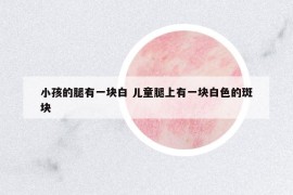 小孩的腿有一块白 儿童腿上有一块白色的斑块