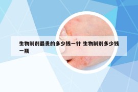 生物制剂最贵的多少钱一针 生物制剂多少钱一瓶