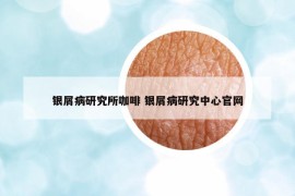 银屑病研究所咖啡 银屑病研究中心官网