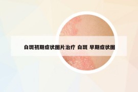 白斑初期症状图片治疗 白斑 早期症状图