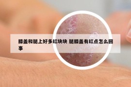 膝盖和腿上好多红块块 腿膝盖有红点怎么回事