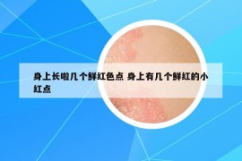 身上长啦几个鲜红色点 身上有几个鲜红的小红点