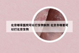 北京哪家医院可以打生物制剂 北京市哪里可以打北京生物