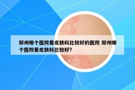 郑州哪个医院看皮肤科比较好的医院 郑州哪个医院看皮肤科比较好?