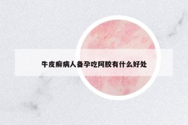 牛皮癣病人备孕吃阿胶有什么好处