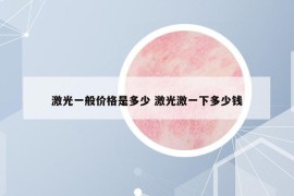 激光一般价格是多少 激光激一下多少钱