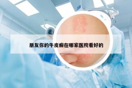 朋友你的牛皮癣在哪家医院看好的