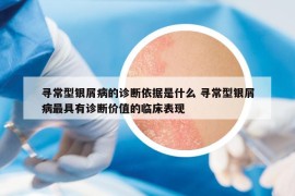 寻常型银屑病的诊断依据是什么 寻常型银屑病最具有诊断价值的临床表现