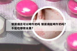 银屑病忌可以喝牛奶吗 银屑病能喝牛奶吗?不能吃哪些水果?