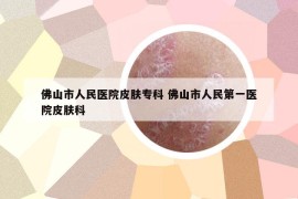 佛山市人民医院皮肤专科 佛山市人民第一医院皮肤科