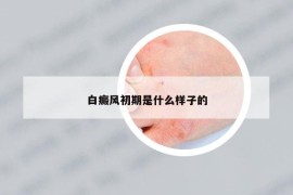 白癜风初期是什么样子的