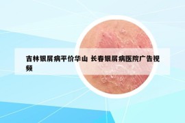 吉林银屑病平价华山 长春银屑病医院广告视频