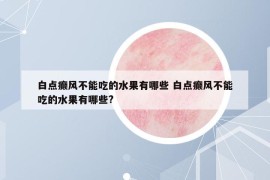 白点癫风不能吃的水果有哪些 白点癫风不能吃的水果有哪些?