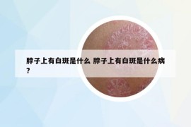 脖子上有白斑是什么 脖子上有白斑是什么病?