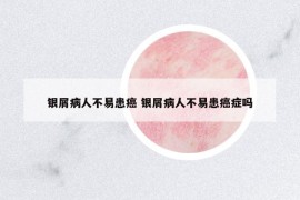 银屑病人不易患癌 银屑病人不易患癌症吗