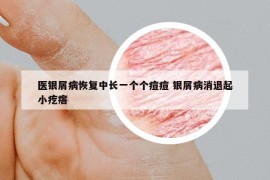 医银屑病恢复中长一个个痘痘 银屑病消退起小疙瘩