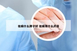 祛癣什么牌子好 祛癣用什么药膏