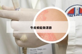 牛皮癣能做漂唇