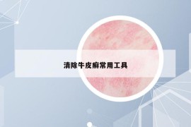 清除牛皮癣常用工具