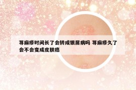荨麻疹时间长了会转成银屑病吗 荨麻疹久了会不会变成皮肤癌