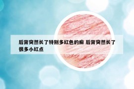 后背突然长了特别多红色的癣 后背突然长了很多小红点