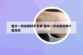 医大一院皮肤科牛皮癣 医大一院皮肤科哪个医生好