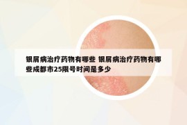 银屑病治疗药物有哪些 银屑病治疗药物有哪些成都市25限号时间是多少