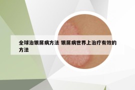 全球治银屑病方法 银屑病世界上治疗有效的方法