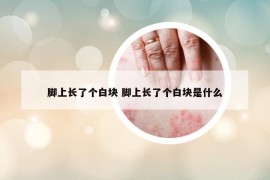 脚上长了个白块 脚上长了个白块是什么