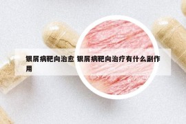 银屑病靶向治愈 银屑病靶向治疗有什么副作用