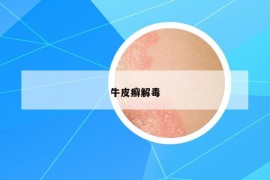 牛皮癣解毒