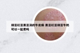绿豆红豆黑豆汤的牛皮癣 黑豆红豆绿豆牛奶可以一起煮吗