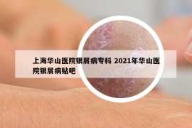 上海华山医院银屑病专科 2021年华山医院银屑病贴吧