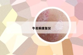 牛皮癣康复仪