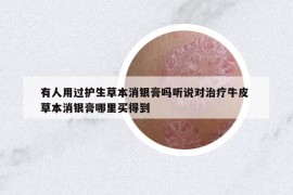 有人用过护生草本消银膏吗听说对治疗牛皮 草本消银膏哪里买得到