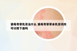 狼毒奇草乳膏治什么 狼毒奇草草本乳膏功效可以擦下面吗