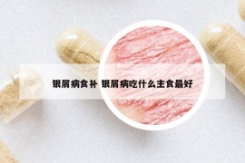 银屑病食补 银屑病吃什么主食最好