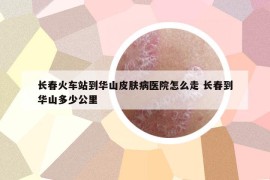 长春火车站到华山皮肤病医院怎么走 长春到华山多少公里
