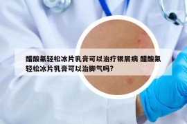 醋酸氟轻松冰片乳膏可以治疗银屑病 醋酸氟轻松冰片乳膏可以治脚气吗?