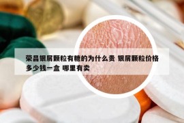 荣昌银屑颗粒有糖的为什么贵 银屑颗粒价格多少钱一盒 哪里有卖